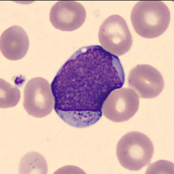 Granulated myeloblast 2